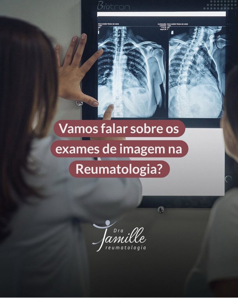 Exames de imagem na Reumatologia