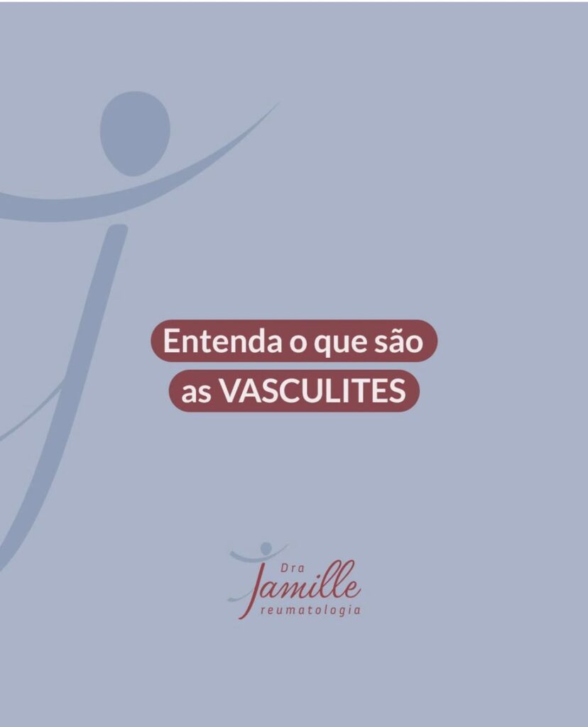 O que você precisa saber sobre vasculites